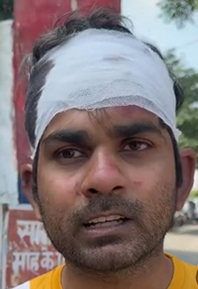 थेरेपिस्ट पर बदमाशों का हमला, मोबाइल और बैग लेकर भागे