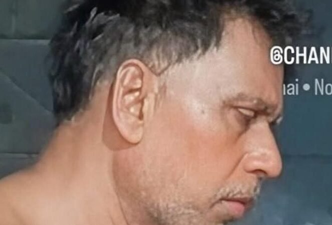 पागल घोड़े के हमले में घायल मजदूर की मौत
